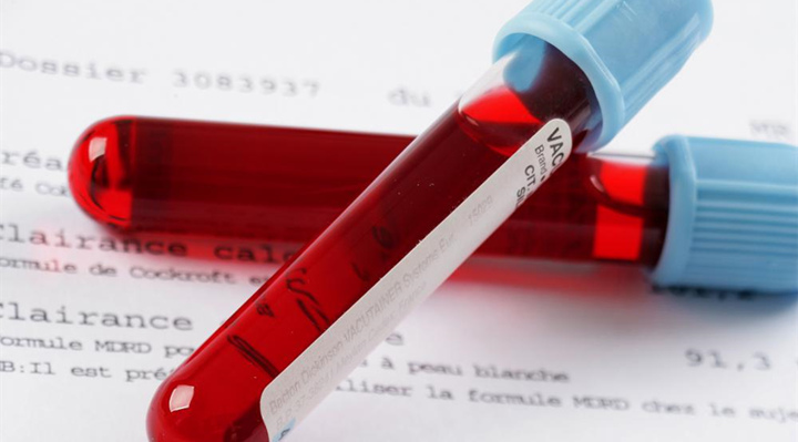 血液檢查應(yīng)注意5點以及紅細(xì)胞壽命測定介紹2